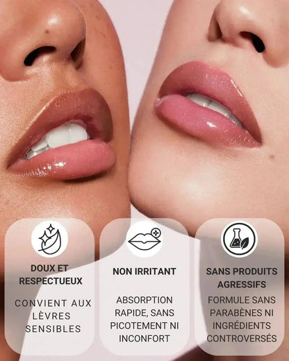 LIPBOOST | Microneedling Lèvres