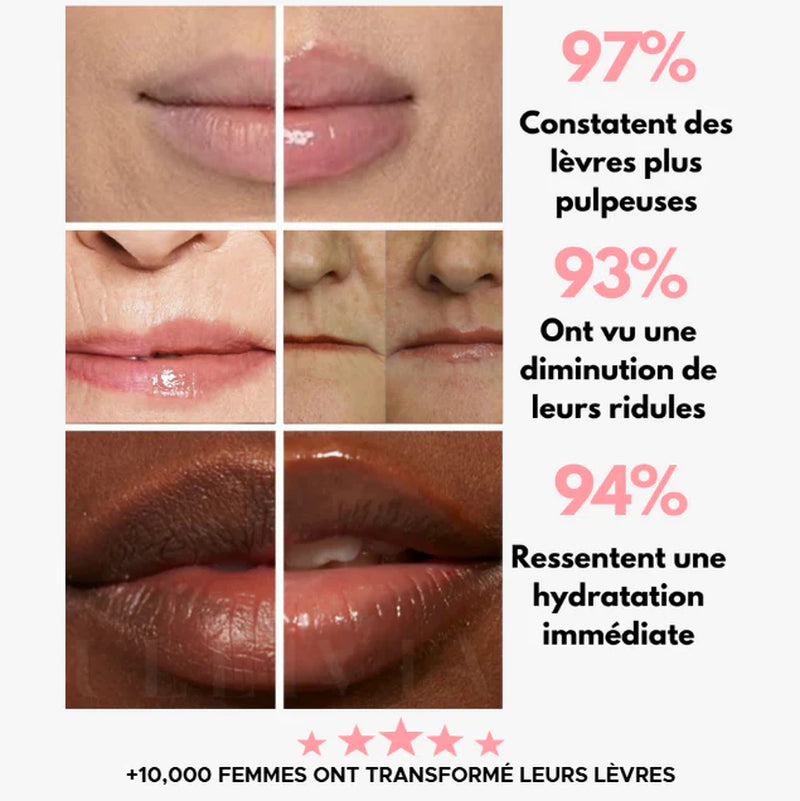 LIPBOOST | Microneedling Lèvres